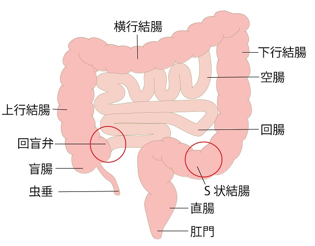 回盲弁とS状結腸