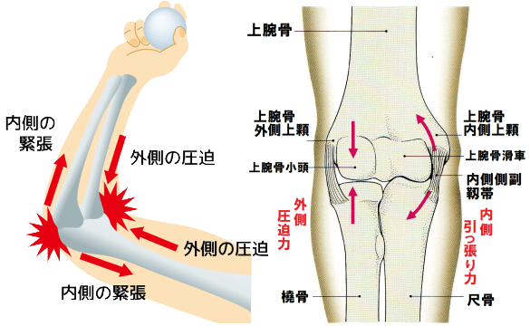 野球肘