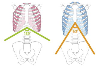 肋骨の減腔