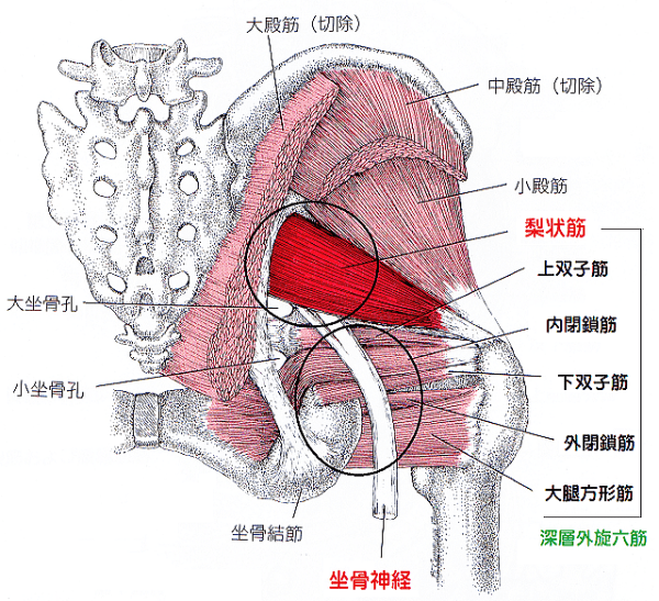 梨状筋症候群