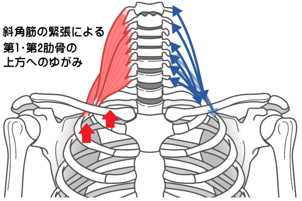 斜角筋と肋骨のゆがみ