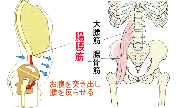 腸腰筋の緊張